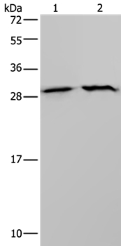 Anti-ETFB Antibody