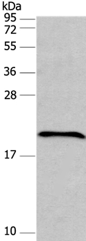 Anti-FAIM Antibody