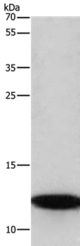 Anti-BRK1 Antibody