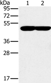 Anti-PPOX Antibody
