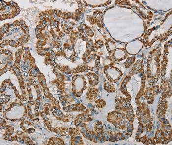 Anti-SDHB Antibody Anti-SDHB Antibody