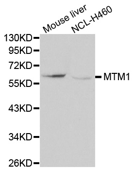 Anti-MTM1 Antibody
