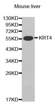 Anti-KRT4 Antibody