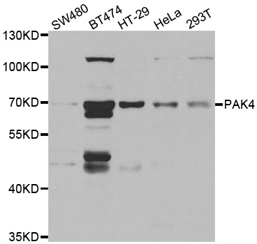 Anti-PAK4 Antibody