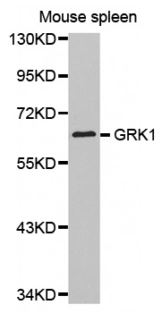 Anti-GRK1 Antibody