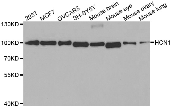 Anti-HCN1 Antibody