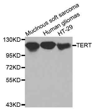 Anti-TERT Antibody