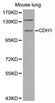 Anti-CDH1 Antibody