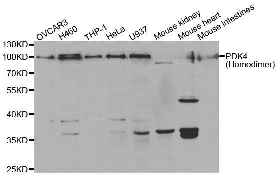 Anti-PDK4 Antibody