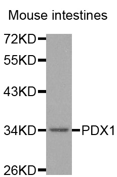Anti-PDX1 Antibody