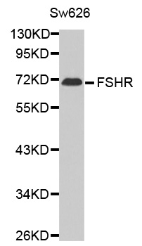 Anti-FSHR Antibody