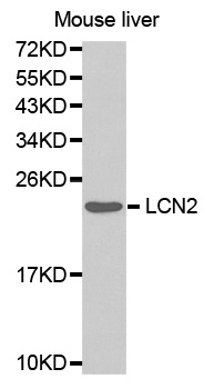 Anti-LCN2 Antibody