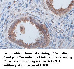 Anti-ECH1 Antibody