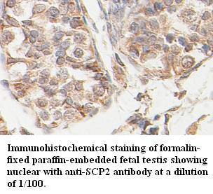 Anti-SCP2 Antibody
