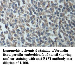 Anti-E2F1 Antibody