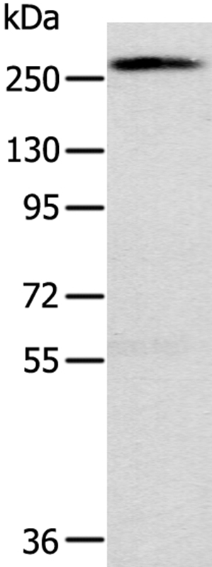 Anti-TLN1 Antibody