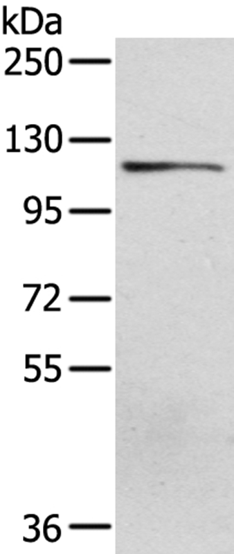Anti-UBA1 Antibody