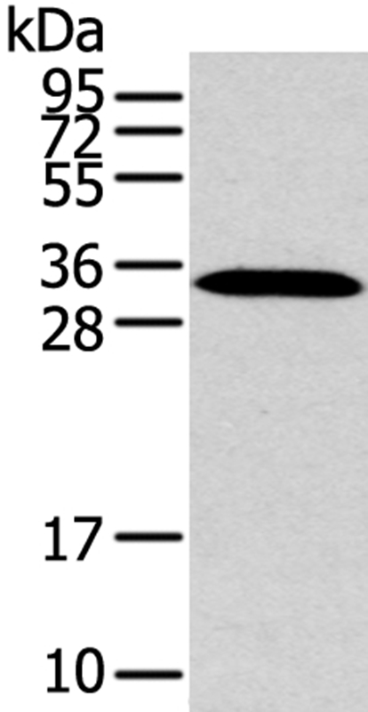 Anti-MSI1 Antibody