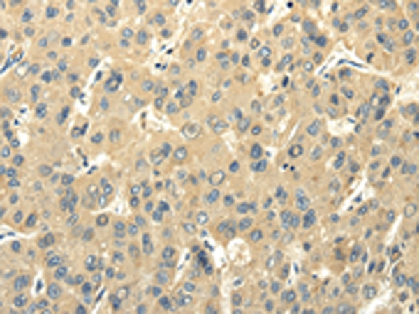 Anti-PMP2 Antibody Anti-PMP2 Antibody
