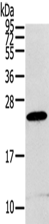 Anti-RGS1 Antibody
