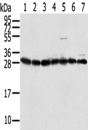 Anti-RPS3 Antibody