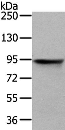 Anti-VIL1 Antibody