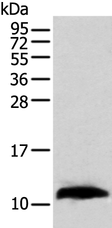 Anti-TBCA Antibody Anti-TBCA Antibody