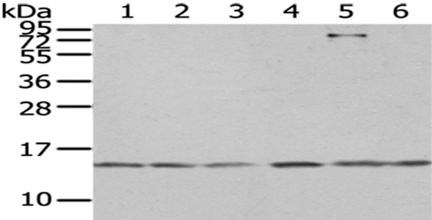 Anti-RBX1 Antibody