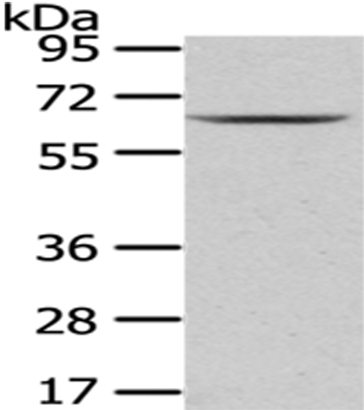 Anti-PKLR Antibody
