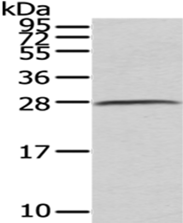 Anti-C1QB Antibody