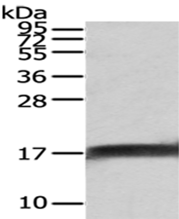 Anti-NPC2 Antibody