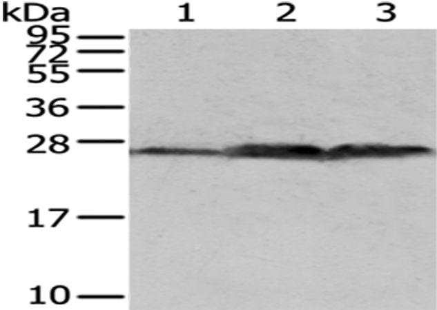 Anti-QDPR Antibody