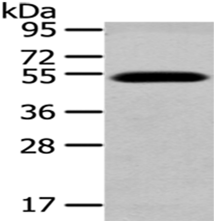 Anti-TCN2 Antibody
