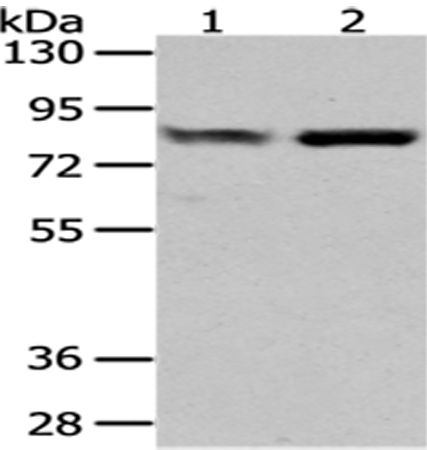 Anti-GUSB Antibody