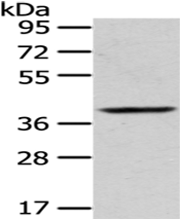 Anti-PLEK Antibody
