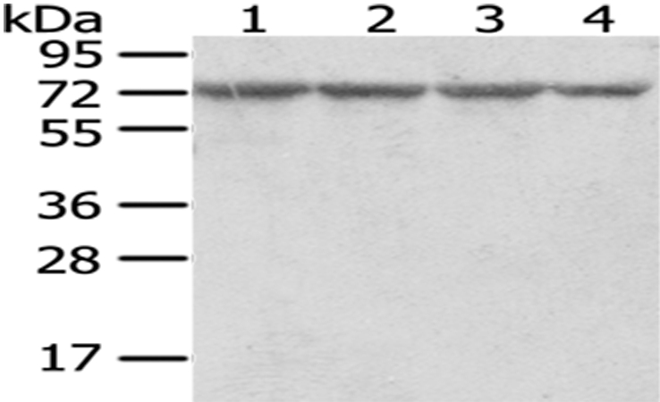 Anti-RARS Antibody