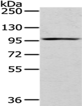 Anti-H6PD Antibody