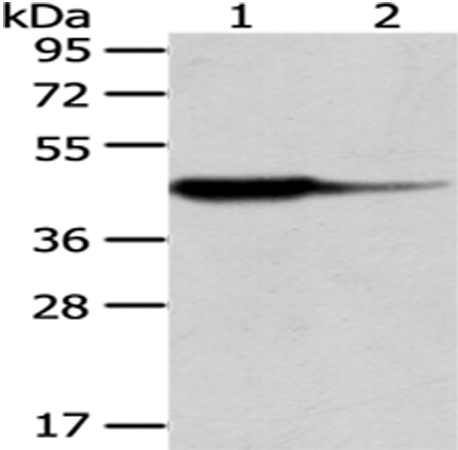Anti-HAO1 Antibody