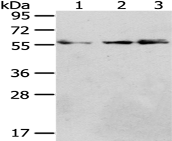 Anti-CCT4 Antibody