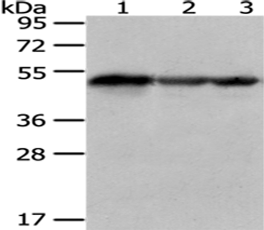 Anti-KYNU Antibody