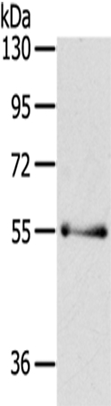 Anti-PAK3 Antibody