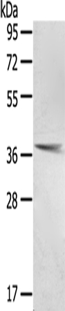 Anti-PTX3 Antibody
