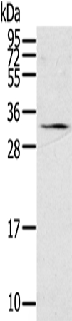 Anti-STAR Antibody