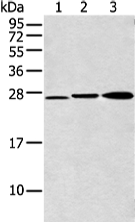 Anti-DCXR Antibody