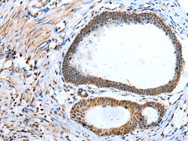 Anti-DCXR Antibody Anti-DCXR Antibody