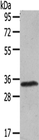 Anti-UCP3 Antibody