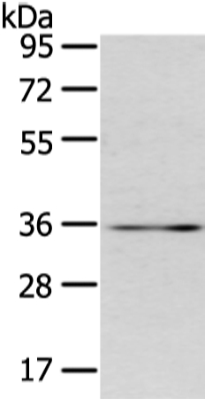 Anti-CDX2 Antibody
