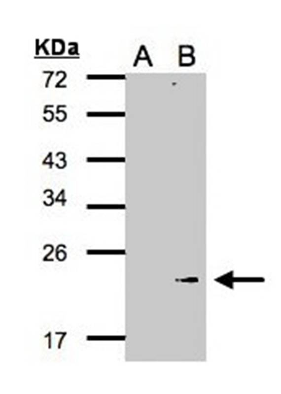 Anti-Glutathione peroxidase 7 Antibody
