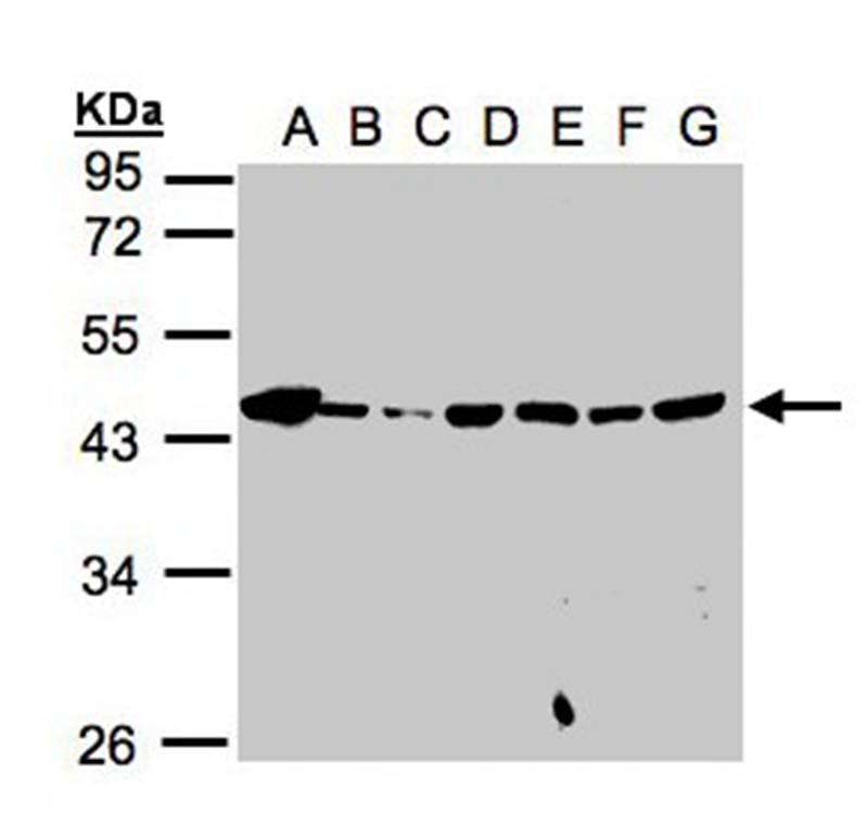 Anti-MPI Antibody