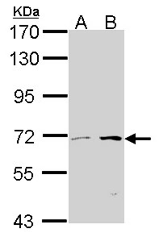 Anti-COT Antibody